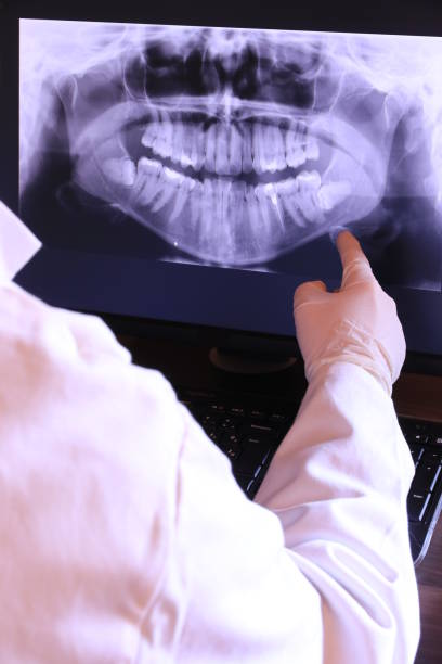 Best Emergency Dentist for Knocked-Out Tooth in Belle Mead, NJ